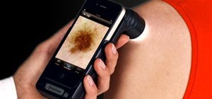 Handyscope, the $1500 Cancer-Checking iPhone Accessory